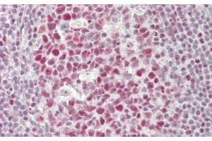 Immunohistochemistry (IHC) image for anti-Nucleolin (NCL) (AA 388-569) antibody (ABIN7434773)