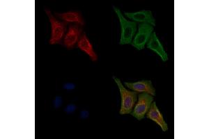 ABIN7093228 and ABIN7097240 staining HepG2 cells(4h of LPS treatment) by IF/ICC.