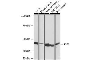 Western blot analysis of extracts of various cell lines, using  Rabbit mAb (ABIN7265669) at 1:1000 dilution. (ASS1 antibody)