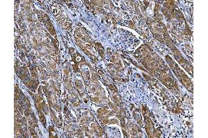 IHC analysis of FRY using anti-FRY antibody (ABIN7599716). (FRY antibody  (AA 11-3013))