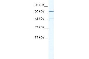 WB Suggested Anti-ZNF419 Antibody Titration:  0.