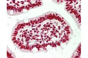 Human Small Intestine: Formalin-Fixed, Paraffin-Embedded (FFPE) (SFPQ antibody  (AA 225-275))