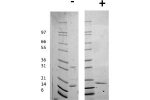 SDS-PAGE of Human Interleukin-16 Recombinant Protein SDS-PAGE of Human Interleukin-16 Recombinant Protein. (IL16 Protein)