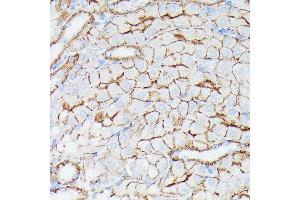 Immunohistochemistry (IHC) image for anti-Interferon-Induced Transmembrane Protein 1 (IFITM1) (C-Term) antibody (ABIN1680390)