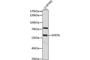 Western blot analysis of extracts of U-87MG cells, using SPRTN antibody (ABIN6131455, ABIN6148388, ABIN6148390 and ABIN6215311) at 1:3000 dilution. (Spartan antibody  (AA 1-240))
