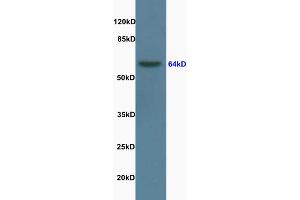 Rat brain lysate probed with Anti Lamin B [Nuclear Envelope Marker] Polyclonal Antibody, Unconjugated (ABIN735203) at 1:200 in 4 °C. (Lamin B1 antibody  (AA 361-460))