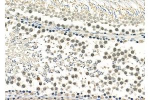 ABIN6259086 and ABIN6275721 at 1/100 staining Rat testis tissue by IHC-P.