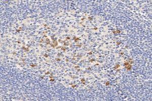 Immunohistochemistry analysis of paraffin-embedded human tonsil using,ME2 (ABIN7074757) at dilution of 1: 6000 (NAD-ME antibody)