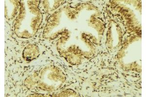 ABIN6277469 at 1/100 staining Mouse colon tissue by IHC-P. (CHI3L1 antibody  (Internal Region))
