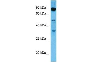 Host:  Rat  Target Name:  DMTF1  Sample Tissue:  Rat Skeletal Muscle  Antibody Dilution:  1ug/ml (DMP1 antibody  (C-Term))
