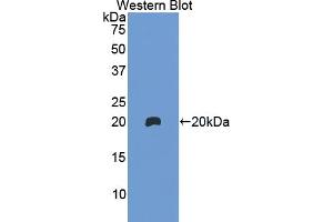 Western blot analysis of the recombinant protein. (Hemoglobin Subunit beta antibody  (AA 1-147))