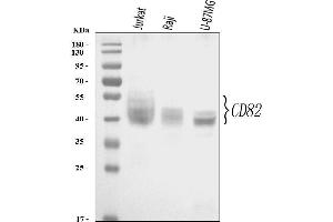 Western blot analysis of CD82 using anti-CD82 antibody (ABIN3043486).