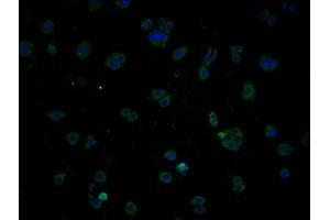Immunofluorescence staining of HepG2 cells with ABIN7140048 at 1:100, counter-stained with DAPI. (LPPR1 antibody  (AA 51-66))
