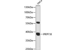 Western blot analysis of extracts of HeLa cells, using PRPF18 antibody (ABIN6132207, ABIN6146254, ABIN6146255 and ABIN6216579) at 1:3000 dilution. (PRPF18 antibody  (AA 1-342))