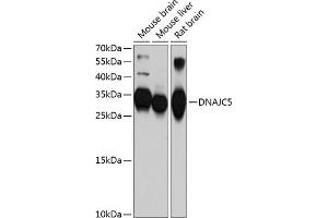 Western blot analysis of extracts of various cell lines, using DN antibody (ABIN6127737, ABIN6139724, ABIN6139725 and ABIN6214762) at 1:1000 dilution.