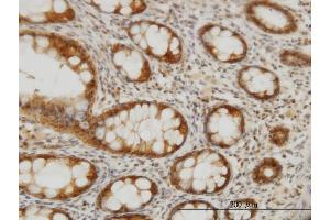Immunoperoxidase of monoclonal antibody to CES2 on formalin-fixed paraffin-embedded human colon. (CES2 antibody  (AA 514-621))