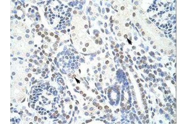 POGZ antibody  (N-Term)