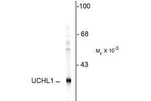 Image no. 1 for anti-Ubiquitin Carboxyl-terminal Esterase L1 (Ubiquitin Thiolesterase) (UCHL1) antibody (ABIN372739) (UCHL1 antibody)