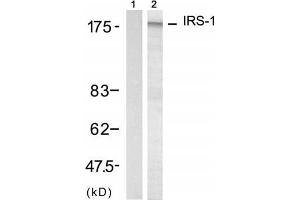 Western blot analysis of extract from 293 cell, using IRS-1 (Ab-312) Antibody (E021166, Lane 1 and 2). (IRS1 antibody)