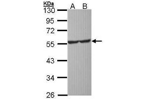 WB Image Sample (30 ug of whole cell lysate) A: Molt-4 , B: Raji 10% SDS PAGE antibody diluted at 1:1000 (Serotonin Receptor 1A antibody)