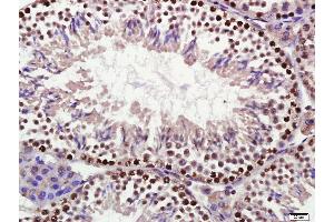 Paraformaldehyde-fixed, paraffin embedded mouse testis, Antigen retrieval by boiling in sodium citrate buffer (pH6) for 15min, Block endogenous peroxidase by 3% hydrogen peroxide for 30 minutes,  Blocking buffer (normal goat serum) at 37°C for 20min, Antibody incubation with DDX4 Polyclonal Antibody (bs-3597R) at 1:400 overnight at 4°C, followed by a conjugated secondary and DAB staining. (DDX4 antibody  (AA 601-700))