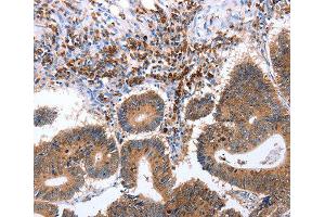 Immunohistochemistry (IHC) image for anti-Ciliary Neurotrophic Factor Receptor (CNTFR) (AA 190-340) antibody (ABIN6219761) (CNTF Receptor alpha antibody  (AA 190-340))