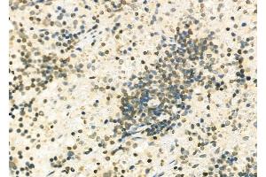 ABIN6263652 and ABIN6279502 at 1/100 staining Rat spleen tissue by IHC-P. (NKX6-2 antibody  (Internal Region))