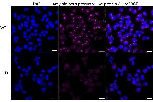 Immunocytochemical staining of HeLa cells using Amyloid beta precursor like protein 2 antibody (ABIN7797595), 1:1,000), Top panel: wild-type (WT), Bottom panal: Amyloid beta precursor like protein 2 shRNA knockdown (KD).