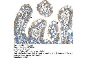 Rabbit Anti-NXF5 Antibody  Paraffin Embedded Tissue: Human Intestine Cellular Data: Epithelial cells of intestinal villas Antibody Concentration: 4. (NXF5 antibody  (Middle Region))