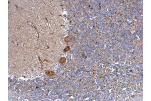 IHC-P Image alpha 1a Adrenergic Receptor antibody detects alpha 1a Adrenergic Receptor protein at cytosol on rat hind brain by immunohistochemical analysis. (alpha 1 Adrenergic Receptor antibody)