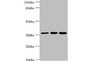 Western blot All lanes: Glutaredoxin-3 antibody at 10 μg/mL Lane 1: Rat brain tissue Lane 2: HepG2 whole cell lysate Lane 3: Hela whole cell lysate Secondary Goat polyclonal to rabbit IgG at 1/10000 dilution Predicted band size: 37 kDa Observed band size: 37 kDa (GLRX3 antibody  (AA 1-335))