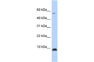 WB Suggested Anti-CXCL6 Antibody Titration: 0. (CXCL6 antibody  (Middle Region))