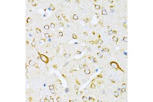 Immunohistochemistry of paraffin-embedded mouse brain using VARS antibody (ABIN1683239, ABIN3018665, ABIN3018666 and ABIN6220533) at dilution of 1:100 (40x lens).