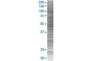 HSPB8 transfected lysate. (HSPB8 293T Cell Transient Overexpression Lysate(Denatured))