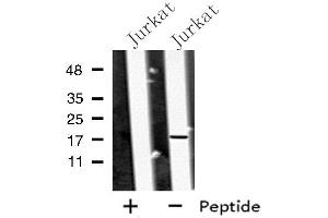 Western blot analysis of MED9 using Jurkat whole cell lysates (MED9 antibody  (Internal Region))