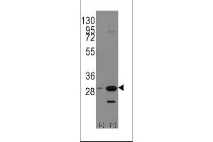 Western blot analysis of PHB1 using rabbit polyclonal PHB1 Antibody (Human C-term) using 293 cell lysates (2 ug/lane) either nontransfected (Lane 1) or transiently transfected with the PHB1 gene (Lane 2). (Prohibitin antibody  (C-Term))