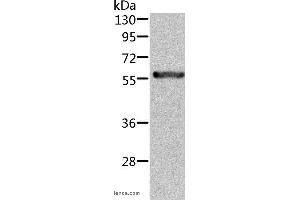 Western blot analysis of Rat kidney tissue, using ALDH6A1 Polyclonal Antibody at dilution of 1:450