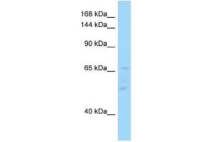 WB Suggested Anti-IL16 Antibody Titration: 1. (IL16 antibody  (C-Term))