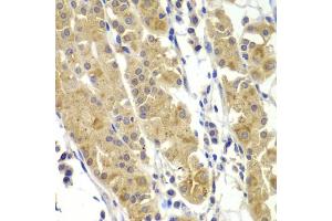 Immunohistochemistry of paraffin-embedded human stomach using MMP14 antibody (ABIN5971375) at dilution of 1/100 (40x lens). (MMP14 antibody)