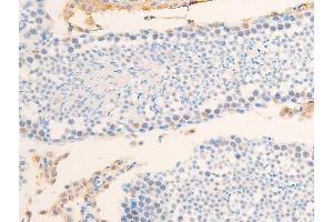 ABIN6267234 at 1/100 staining mouse testis tissue sections by IHC-P. (Survivin antibody  (pThr117))
