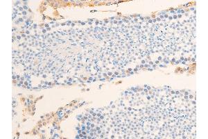 ABIN6267234 at 1/100 staining mouse testis tissue sections by IHC-P.