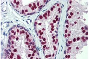 Human Prostate: Formalin-Fixed, Paraffin-Embedded (FFPE) (CUL9 antibody)