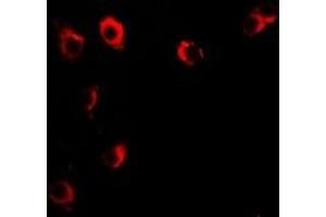 Immunofluorescent analysis of VILIP-1 staining in U2OS cells. (VSNL1 antibody)