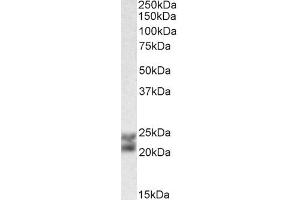 Western Blotting (WB) image for anti-Caveolin 1, Caveolae Protein, 22kDa (CAV1) (Internal Region) antibody (ABIN185421)