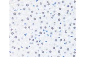 Immunohistochemistry of paraffin-embedded Rat liver using BRMS1 Polyclonal Antibody at dilution of 1:100 (40x lens). (BRMS1 antibody)