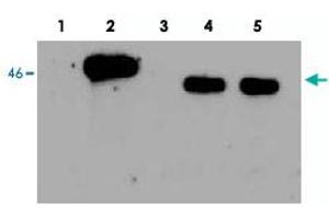 Western Blot analysis of human EGLN1, using EGLN1 polyclonal antibody . (EGLN1 antibody)
