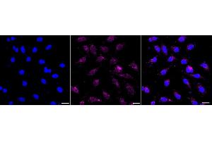 Immunocytochemical staining of HeLa cells with RAB4A antibody (ABIN7800097), 1:1,000).