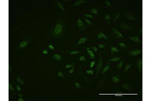 Immunofluorescence of monoclonal antibody to TFAP2A on HeLa cell. (TFAP2A antibody  (AA 99-205))