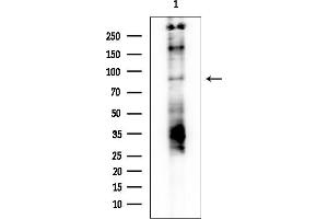 anti-Glycogen Synthase (GYS) (pSer645) antibody