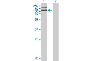 Lane 1: ADAR transfected lysate ( 136 KDa) Lane 2: Non-transfected lysate. (ADAR 293T Cell Transient Overexpression Lysate(Denatured))